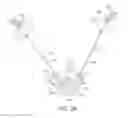 Fig. 04 - Systems and methods for vertebral or other bone structure height restoration and stabilization