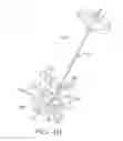 Fig. 11 - Systems and methods for vertebral or other bone structure height restoration and stabilization