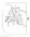 Fig. 05 - Instrumentation and technique for sizing a bone reconstruction graft