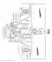Fig. 12 - Instrumentation and technique for sizing a bone reconstruction graft