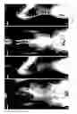 Fig. 03 - ROBOTIC SURGICAL SYSTEMS AND METHODS FOR ROD BENDING