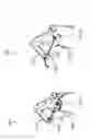 Fig. 11 - ROBOTIC SURGICAL SYSTEMS AND METHODS FOR ROD BENDING