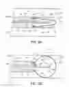 Fig. 03 - Neuromodulation cryotherapeutic devices and associated systems and methods