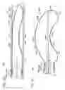 Fig. 43 - Neuromodulation cryotherapeutic devices and associated systems and methods
