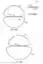 Fig. 56 - Neuromodulation cryotherapeutic devices and associated systems and methods