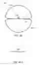 Fig. 57 - Neuromodulation cryotherapeutic devices and associated systems and methods