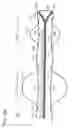 Fig. 64 - Neuromodulation cryotherapeutic devices and associated systems and methods