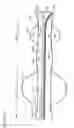 Fig. 65 - Neuromodulation cryotherapeutic devices and associated systems and methods
