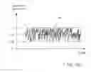 Fig. 07 - RANDOM PULSED HIGH FREQUENCY THERAPY