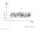 Fig. 08 - RANDOM PULSED HIGH FREQUENCY THERAPY