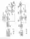 Fig. 12 - RANDOM PULSED HIGH FREQUENCY THERAPY
