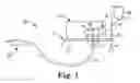 Fig. 02 - Multipurpose electrosurgical device