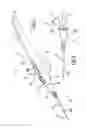Fig. 02 - Electrosurgical handpiece