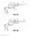 Fig. 06 - Laparoscopic Surgical Instrument