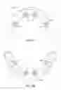 Fig. 09 - DENTAL ABUTMENTS AND ASSOCIATED SYSTEMS AND METHODS