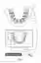 Fig. 02 - Method for performing an optical three-dimensional recording