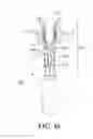 Fig. 17 - ORAL HYGIENE SYSTEMS AND METHODS