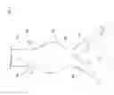 Fig. 02 - ENDOGRAFT WITH ONE OR MORE APERTURES