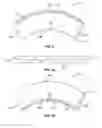 Fig. 03 - Pre-Curved Stent Graft and Methods for Use