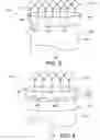 Fig. 03 - Low profile stent graft and delivery system