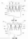 Fig. 04 - Low profile stent graft and delivery system