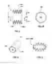 Fig. 03 - Prosthetic valve system having a docking component and a prosthetic valve component