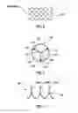 Fig. 04 - Prosthetic valve system having a docking component and a prosthetic valve component