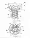 Fig. 02 - TRANSCATHETER VALVE PROSTHESES HAVING A SEALING COMPONENT FORMED FROM TISSUE HAVING AN ALTERED EXTRACELLULAR MATRIX