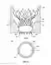 Fig. 07 - TRANSCATHETER VALVE PROSTHESES HAVING A SEALING COMPONENT FORMED FROM TISSUE HAVING AN ALTERED EXTRACELLULAR MATRIX