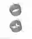 Fig. 04 - Methods and apparatus for endovascularly replacing a heart valve