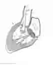Fig. 07 - Methods and apparatus for endovascularly replacing a heart valve