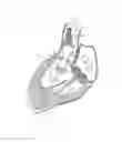 Fig. 08 - Methods and apparatus for endovascularly replacing a heart valve