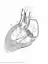 Fig. 09 - Methods and apparatus for endovascularly replacing a heart valve