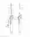 Fig. 41 - Methods and apparatus for endovascularly replacing a heart valve