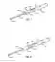 Fig. 06 - Inversion delivery device and method for a prosthesis