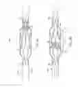 Fig. 09 - Venous valve prosthesis