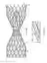 Fig. 22 - Venous valve prosthesis