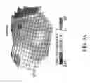 Fig. 05 - Customized bendable osteochondral allografts