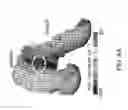 Fig. 07 - Customized bendable osteochondral allografts