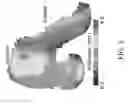 Fig. 09 - Customized bendable osteochondral allografts