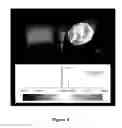 Fig. 06 - Modification of the surface topography of cartilage grafts for joint reconstruction