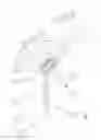Fig. 02 - Implantable prosthesis for replacing the human knee joint