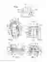 Fig. 03 - Ankle prosthesis with simplified adjustment