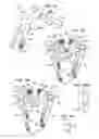 Fig. 09 - Crossbar spinal prosthesis having a modular design and systems for treating spinal pathologies