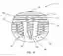 Fig. 07 - Interbody spacer