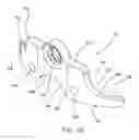 Fig. 23 - Interbody spacer