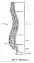 Fig. 02 - Implantable orthopedic device component selection instrument and methods
