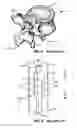 Fig. 04 - Implantable orthopedic device component selection instrument and methods