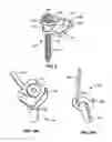 Fig. 07 - Implantable orthopedic device component selection instrument and methods