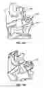 Fig. 09 - Implantable orthopedic device component selection instrument and methods